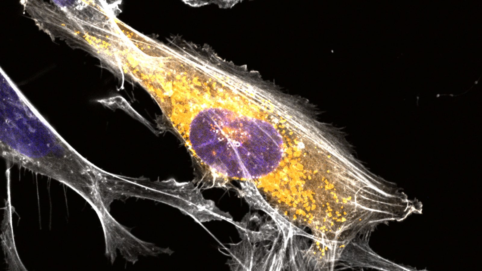 Microglia microscopy from the Salk microprotein and Alzheimer study