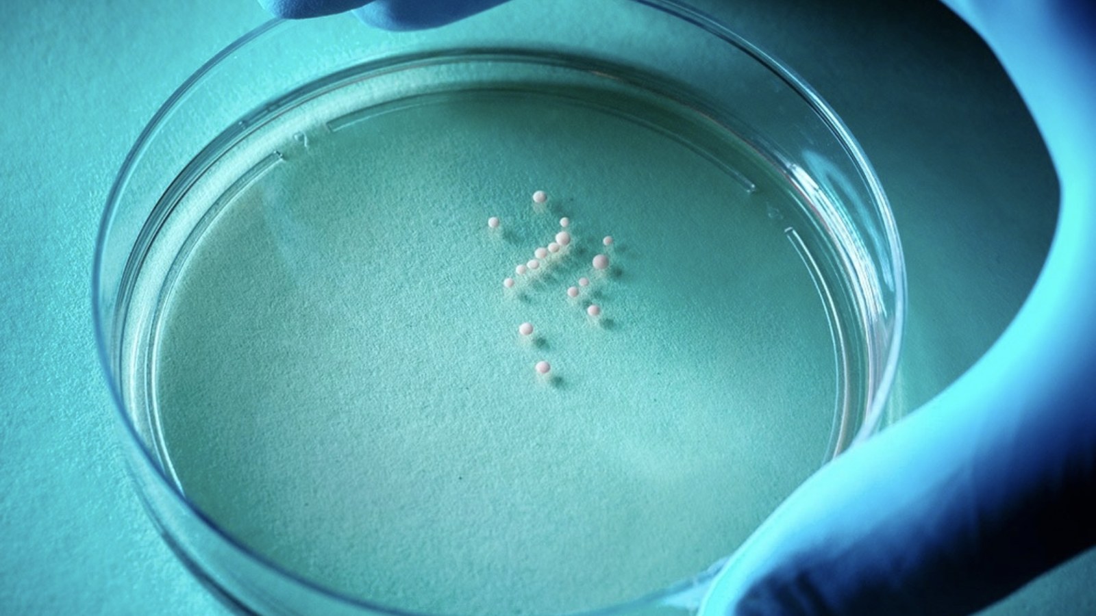 Human brain organoids in a Petri dish, Stanford laboratory image